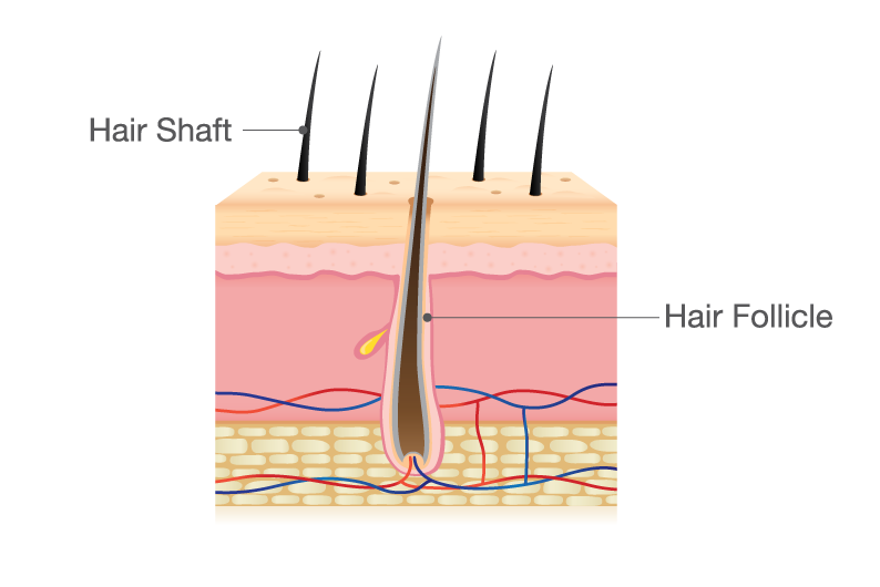 Understand Hair Shaft defects - Causes, Symptoms & Solutions | RichFeel